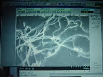 Electron Microscope: LIVE